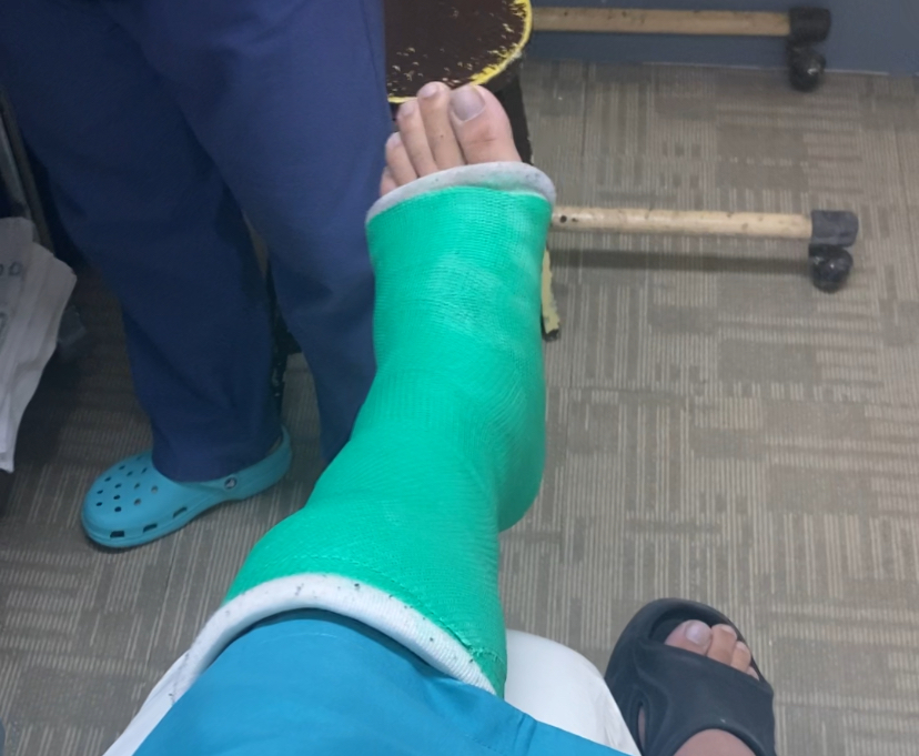 ダバオ　病院　ギブス